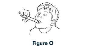 How to administer Quillivant XR methylphenidate - Step 10: Figure O - Child with oral dosing syringe